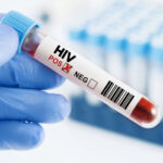 US Funding Impedes HIV Services in Mozambique