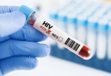 US Funding Impedes HIV Services in Mozambique